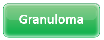 Granuloma