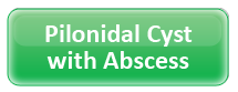 Pilonidal Cyst with Abscess