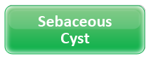 Sebaceous Cyst
